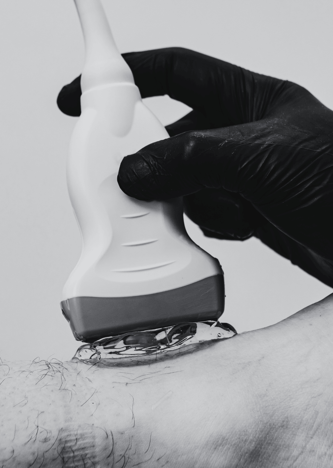 XLVIII Ecografía Musculoesquelética
